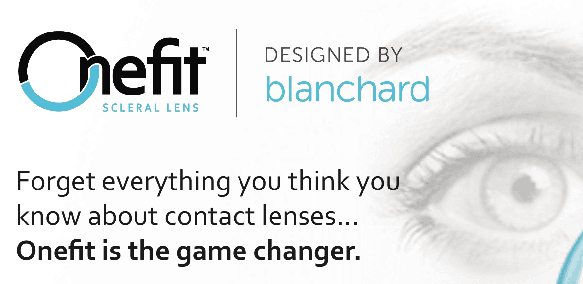 Onefit scleral contact lens for keratoconus and irregular corneas